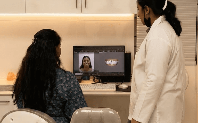 Smile Design treatment